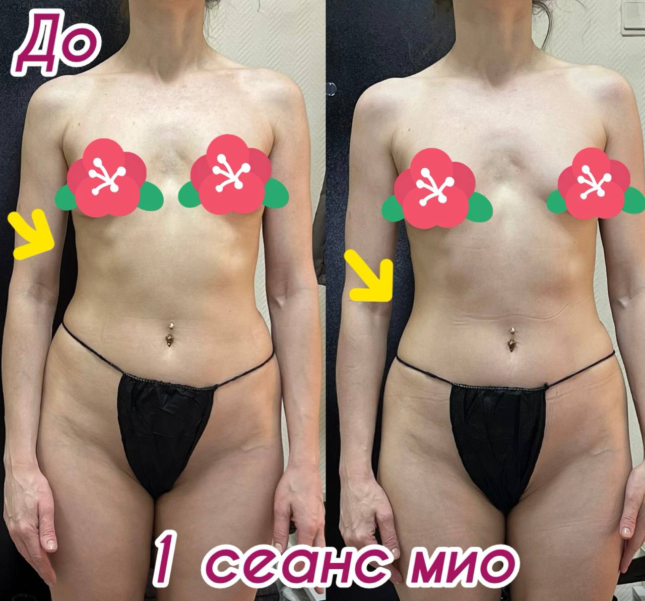 До и после