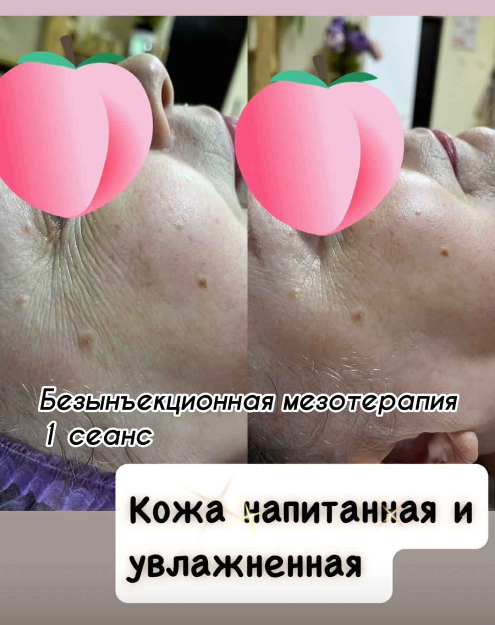 До и после